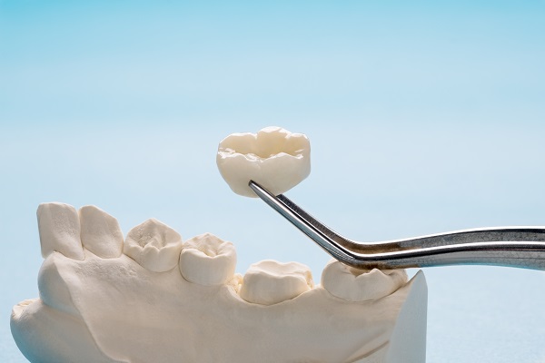 Dental Crown Solutions: Strengthening And Protecting Damaged Teeth