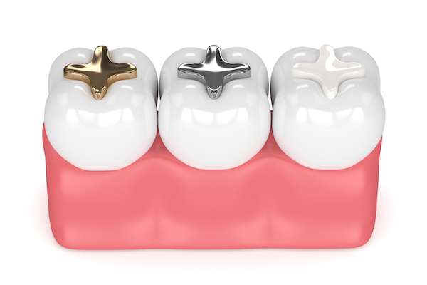 A General Dentist Discusses Different Filling Options from Integrity Family Dental in Denver, CO